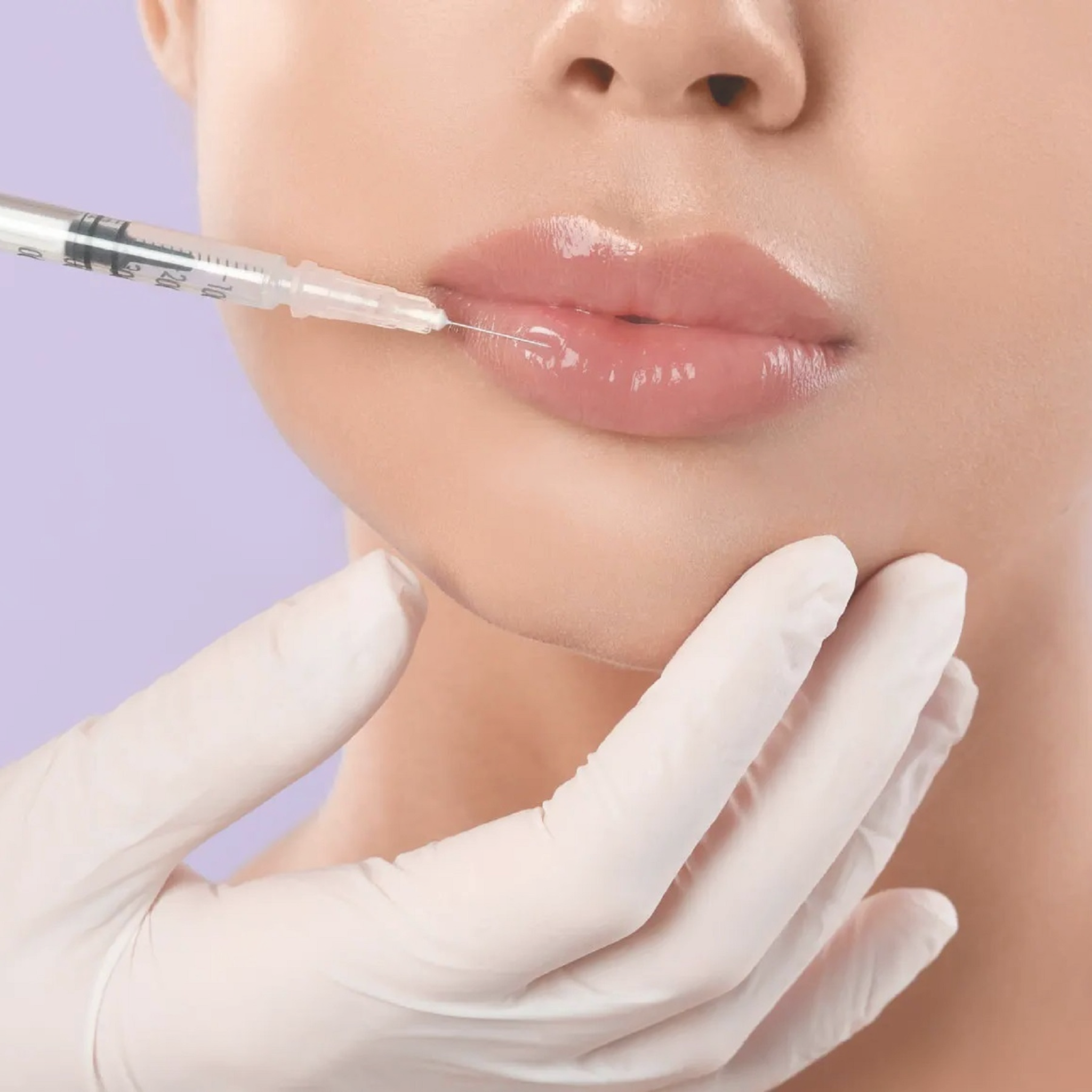 Dermal Fillers